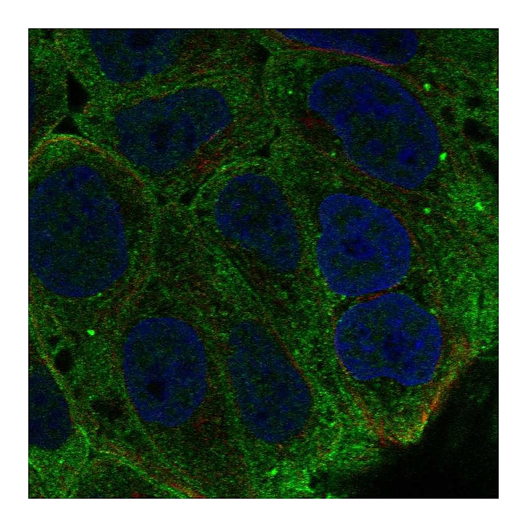 Atlas Antibodies Anti-SPINT1 Antibody