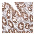 Atlas Antibodies Anti-SPINT2 Antibody