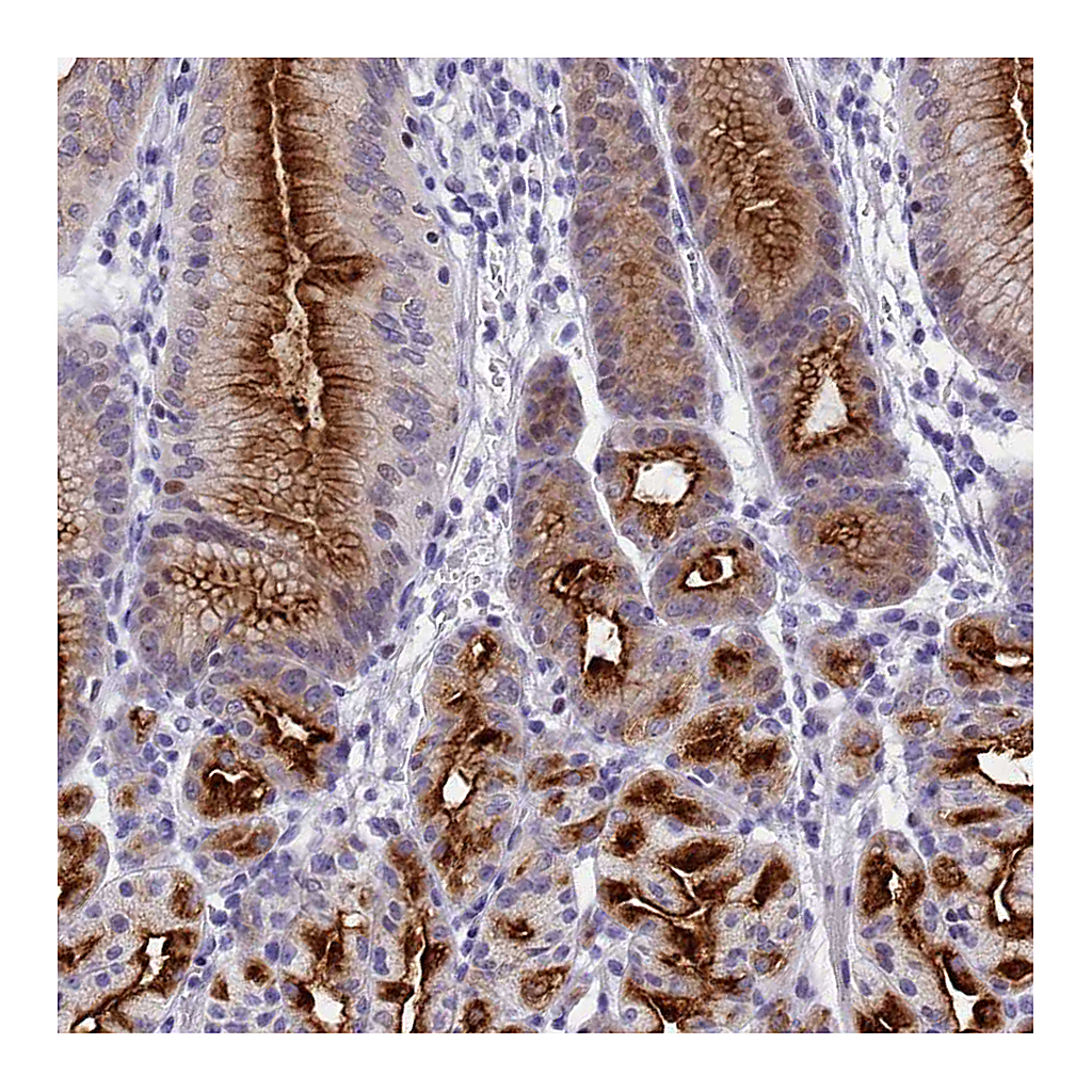 Atlas Antibodies Anti-SPIRE2 Antibody