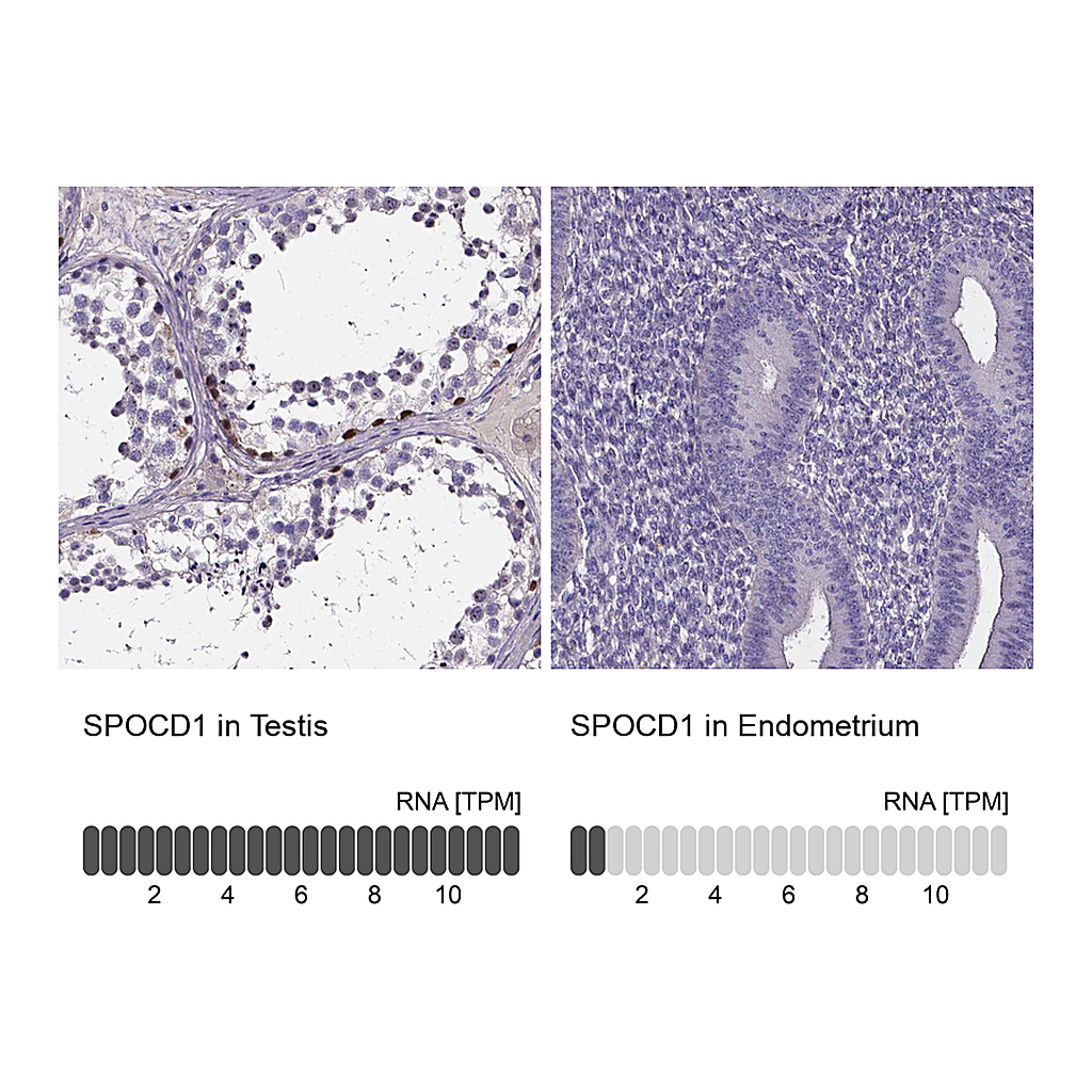 Atlas Antibodies Anti-SPOCD1 Antibody