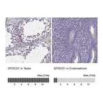 Atlas Antibodies Anti-SPOCD1 Antibody