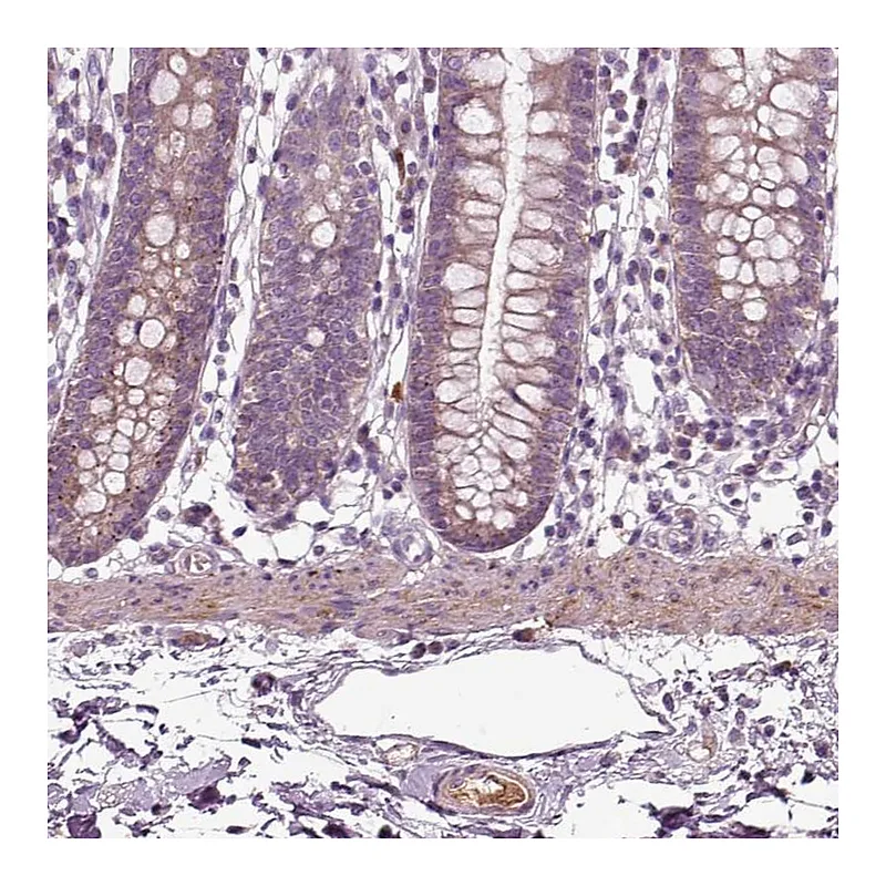 Atlas Antibodies Anti-SPON1 Antibody