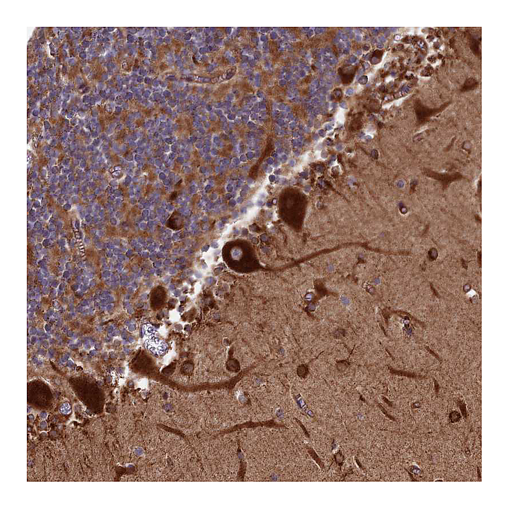 Atlas Antibodies Anti-SPOCK2 Antibody