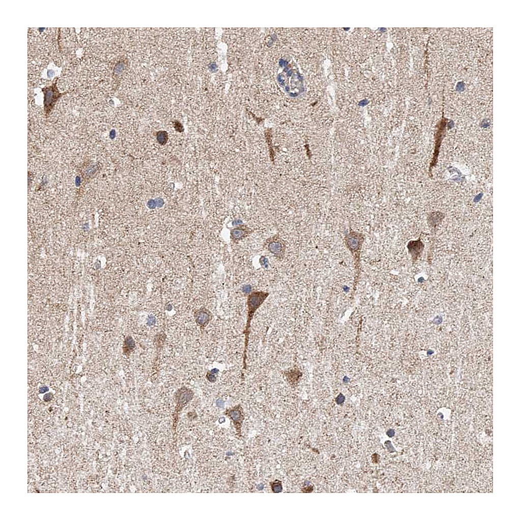 Atlas Antibodies Anti-SPOCK1 Antibody