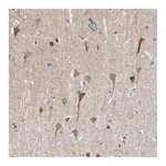 Atlas Antibodies Anti-SPOCK1 Antibody