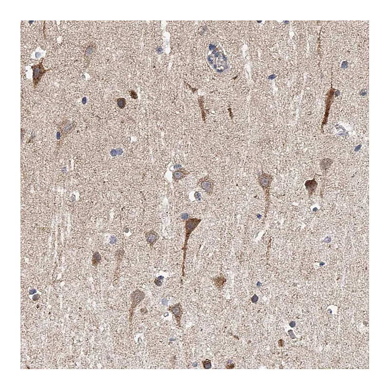 Atlas Antibodies Anti-SPOCK1 Antibody