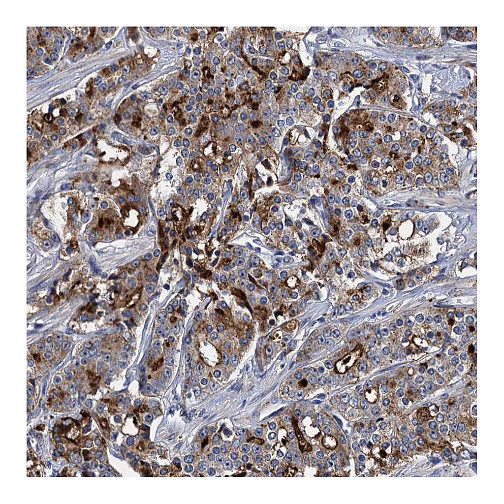 Atlas Antibodies Anti-SPON2 Antibody