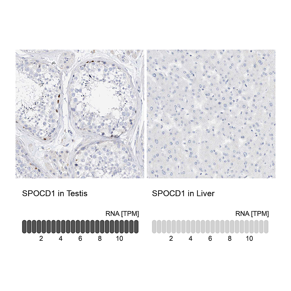 Atlas Antibodies Anti-SPOCD1 Antibody