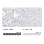Atlas Antibodies Anti-SPOCD1 Antibody