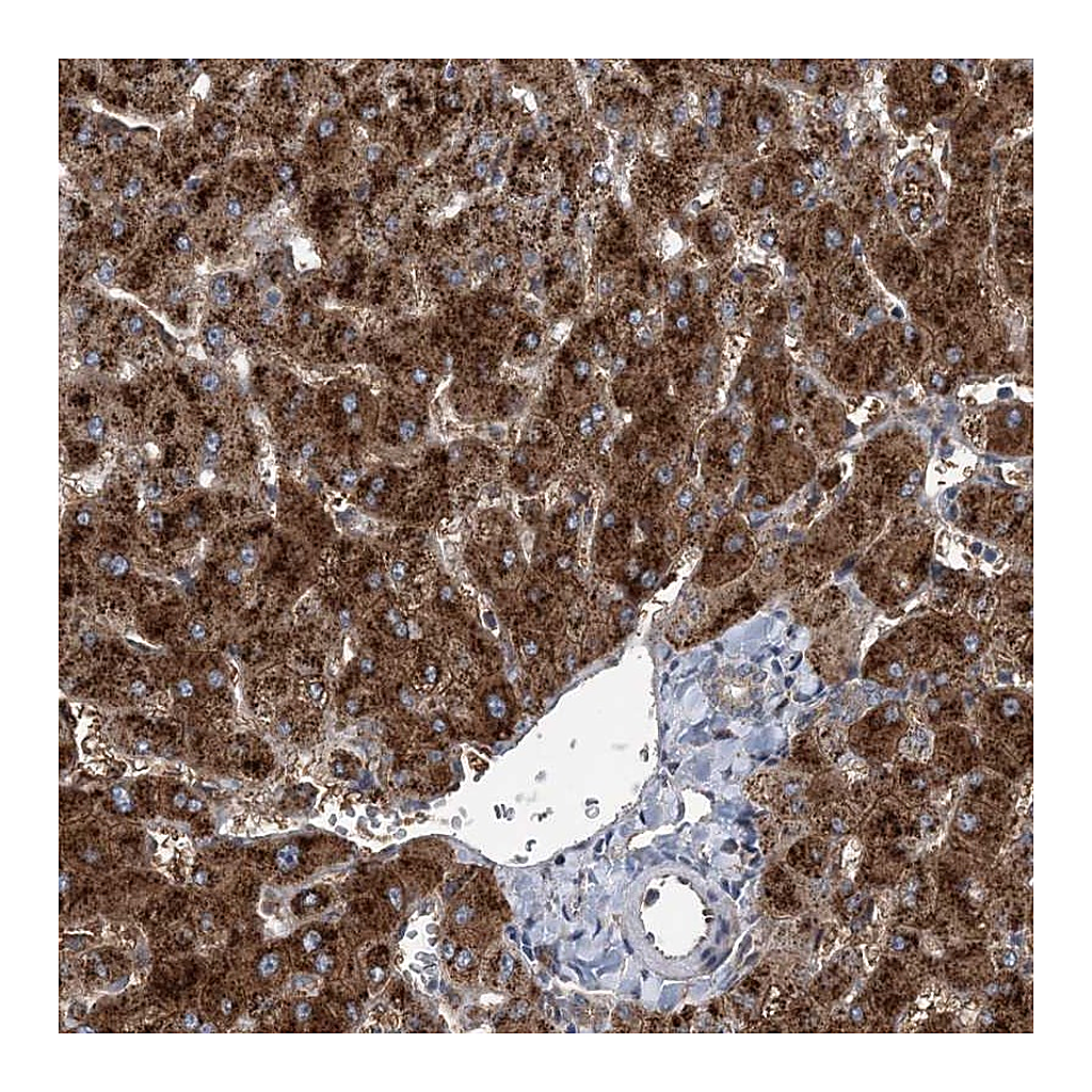 Atlas Antibodies Anti-SPOPL Antibody