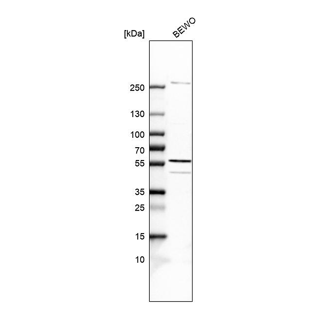 Atlas Antibodies Anti-SPOUT1 Antibody