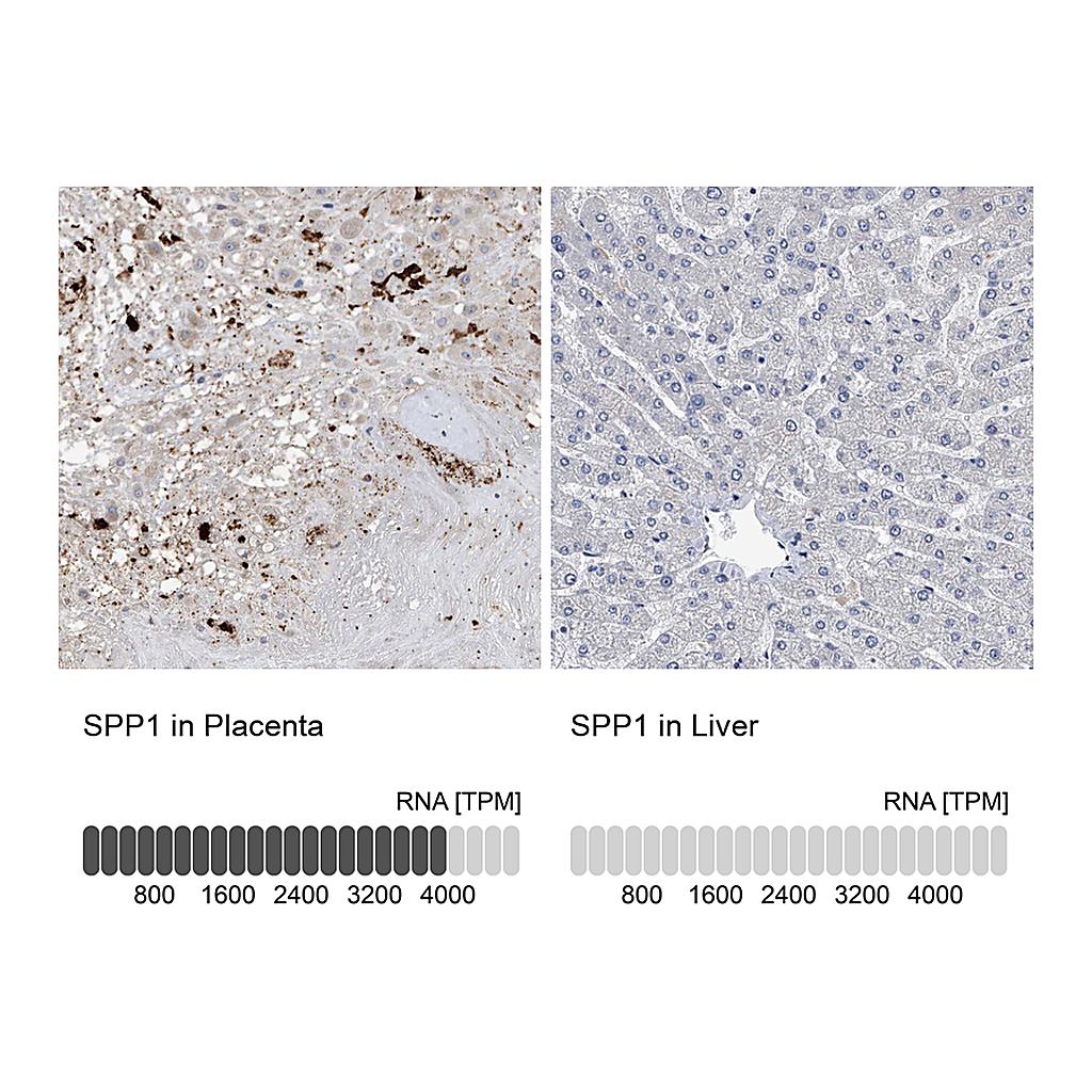 Atlas Antibodies Anti-SPP1 Antibody