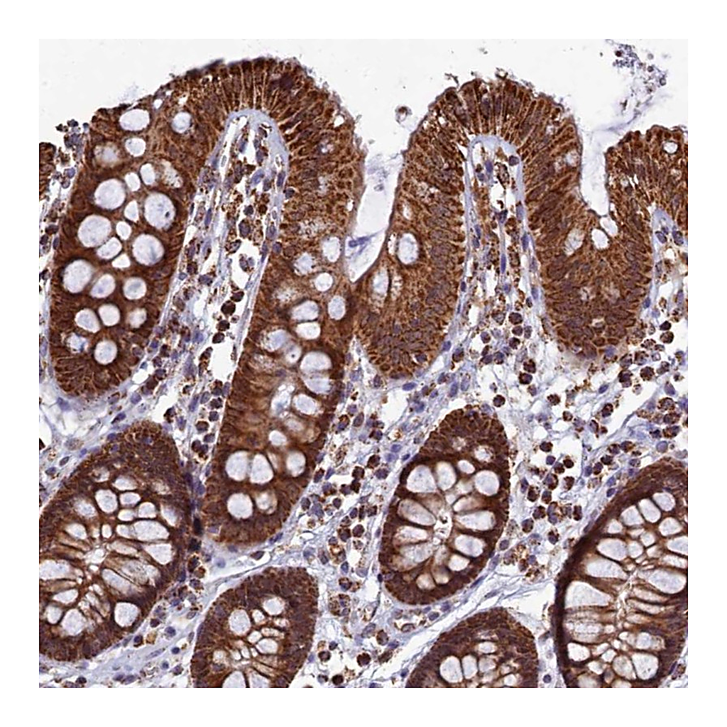 Atlas Antibodies Anti-SPR Antibody