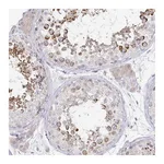 Atlas Antibodies Anti-SPPL3 Antibody