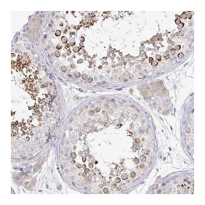 Atlas Antibodies Anti-SPPL3 Antibody