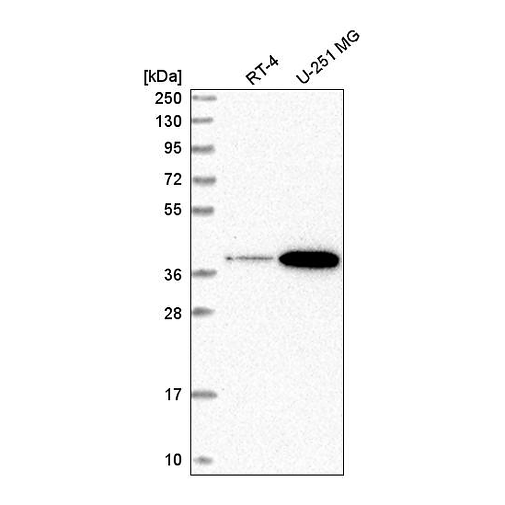Atlas Antibodies Anti-SPPL2B Antibody