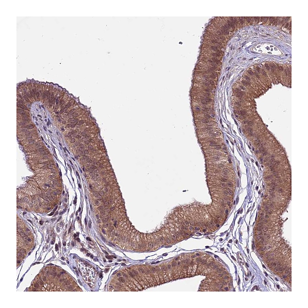 Atlas Antibodies Anti-SPRED1 Antibody