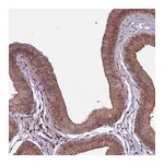 Atlas Antibodies Anti-SPRED1 Antibody