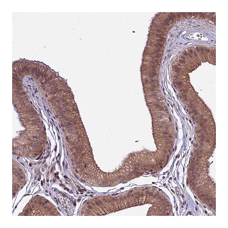 Atlas Antibodies Anti-SPRED1 Antibody