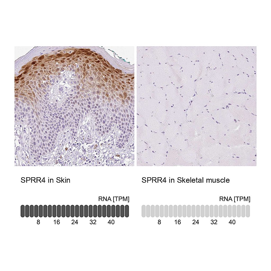 Atlas Antibodies Anti-SPRR4 Antibody