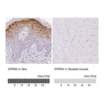 Atlas Antibodies Anti-SPRR4 Antibody
