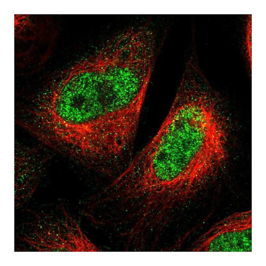 Atlas Antibodies Anti-SPRTN Antibody