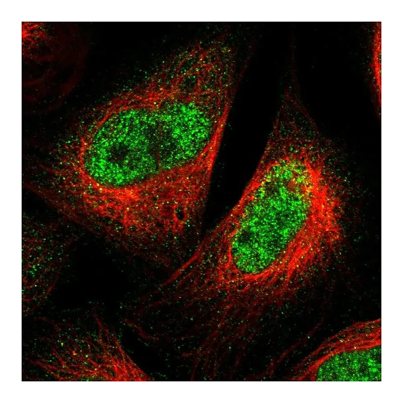 Atlas Antibodies Anti-SPRTN Antibody