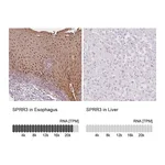 Atlas Antibodies Anti-SPRR3 Antibody