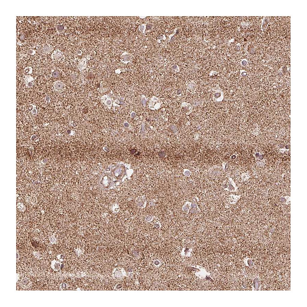 Atlas Antibodies Anti-SPRED2 Antibody