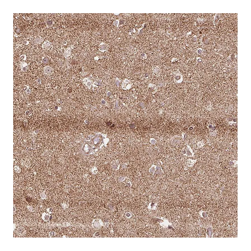 Atlas Antibodies Anti-SPRED2 Antibody