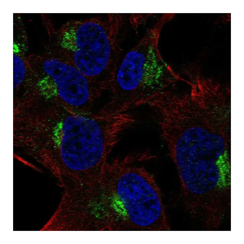 Atlas Antibodies Anti-SPRY4 Antibody