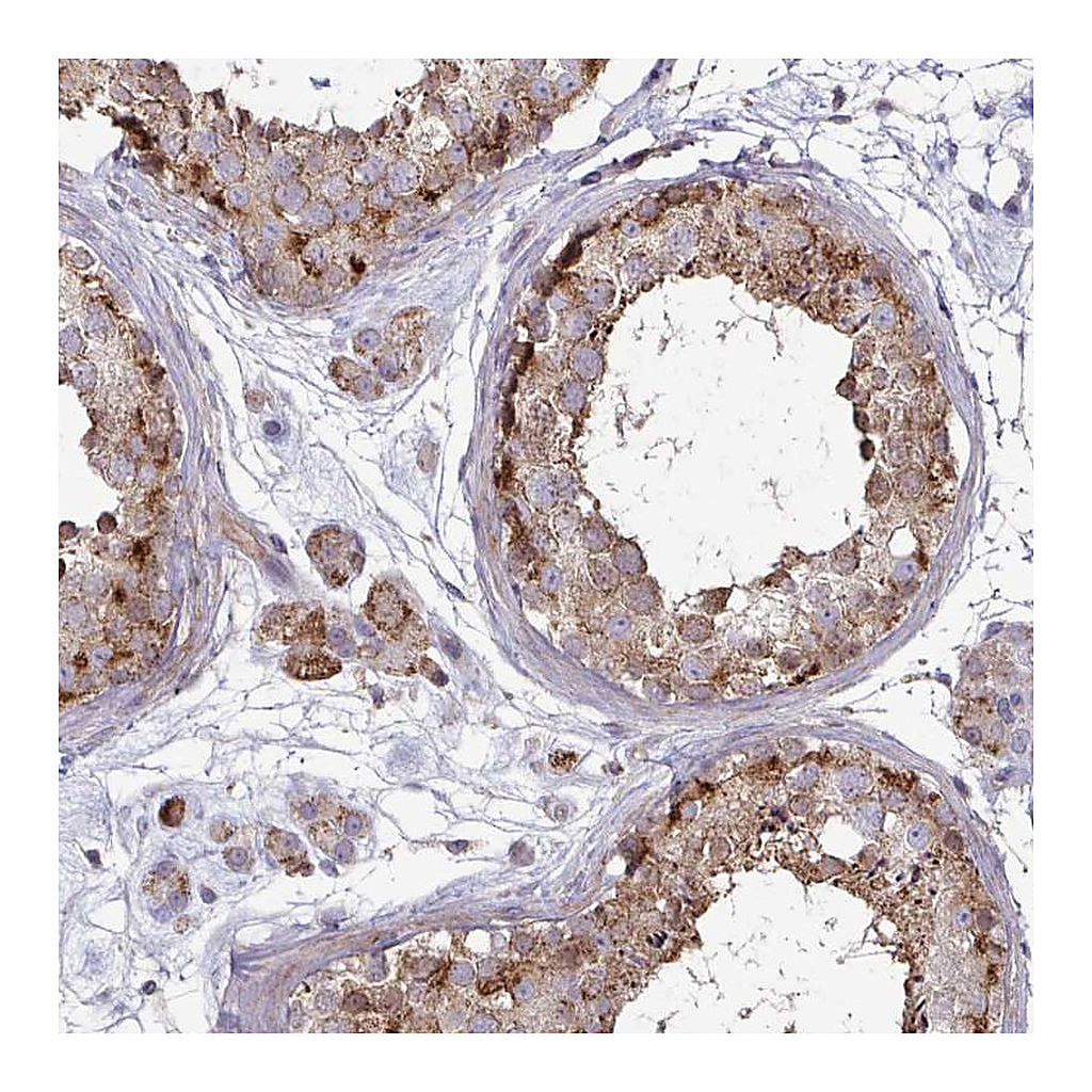 Atlas Antibodies Anti-SPRY1 Antibody