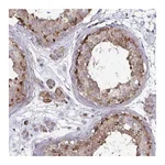 Atlas Antibodies Anti-SPRY1 Antibody