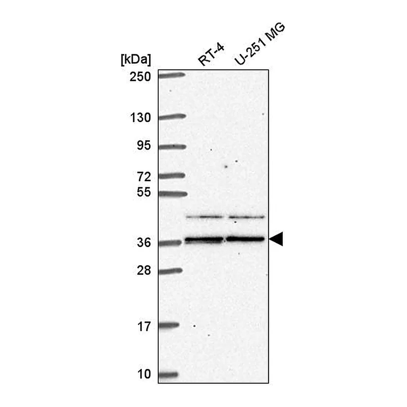 Atlas Antibodies Anti-SPRY1 Antibody