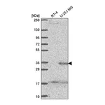 Atlas Antibodies Anti-SPRY4 Antibody