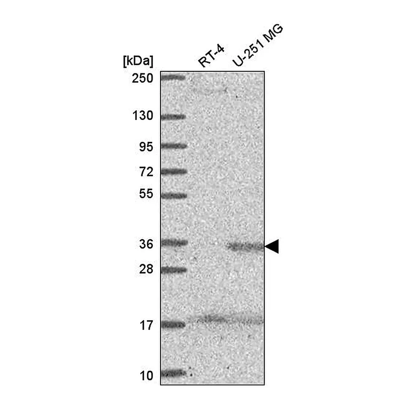 Atlas Antibodies Anti-SPRY4 Antibody