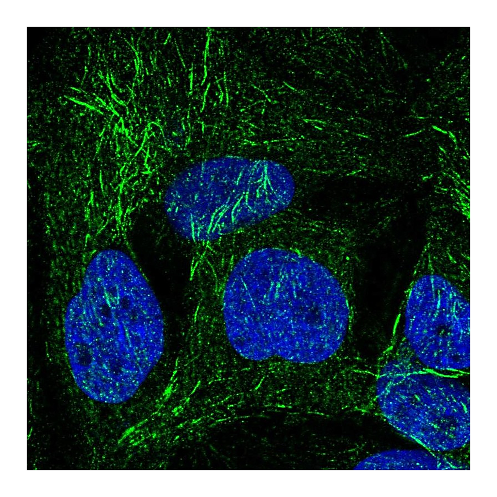 Atlas Antibodies Anti-SPRY2 Antibody