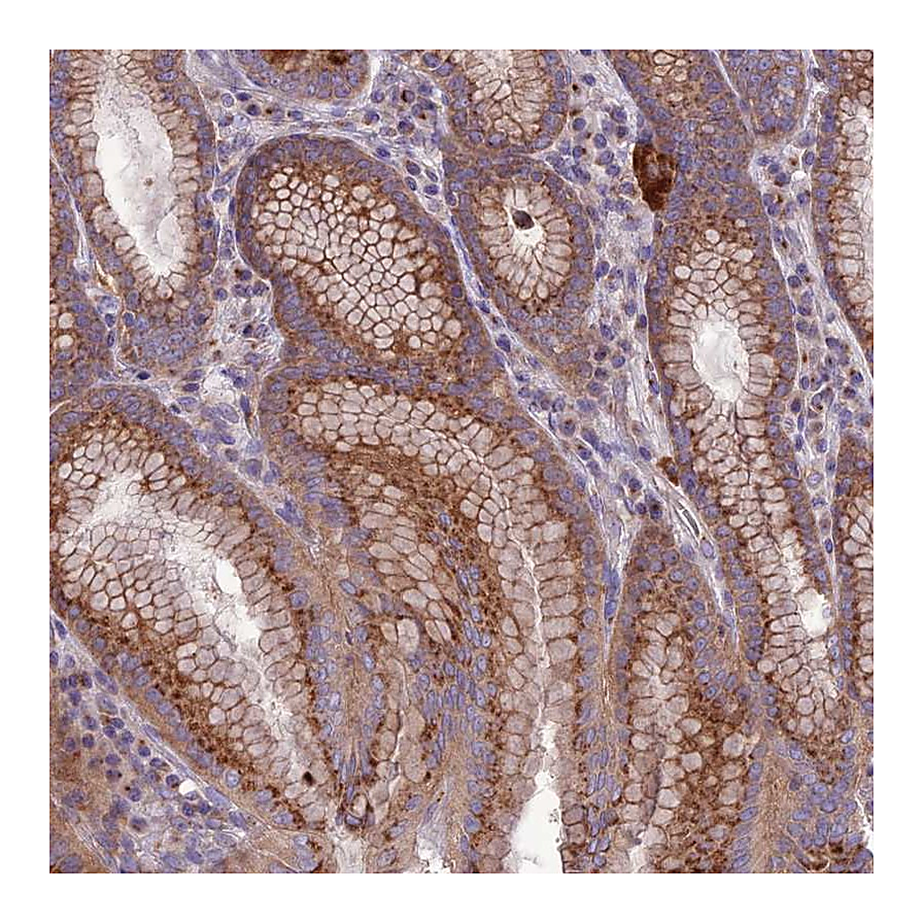 Atlas Antibodies Anti-SPRYD7 Antibody