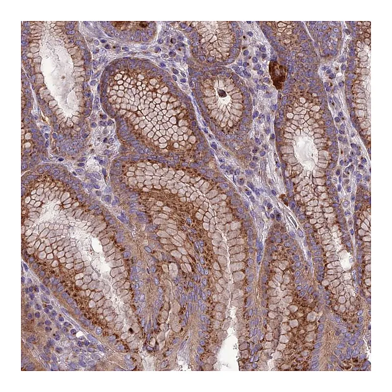 Atlas Antibodies Anti-SPRYD7 Antibody