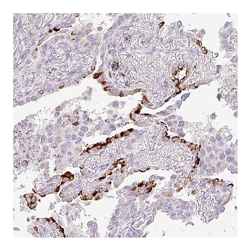 Atlas Antibodies Anti-SPRYD4 Antibody