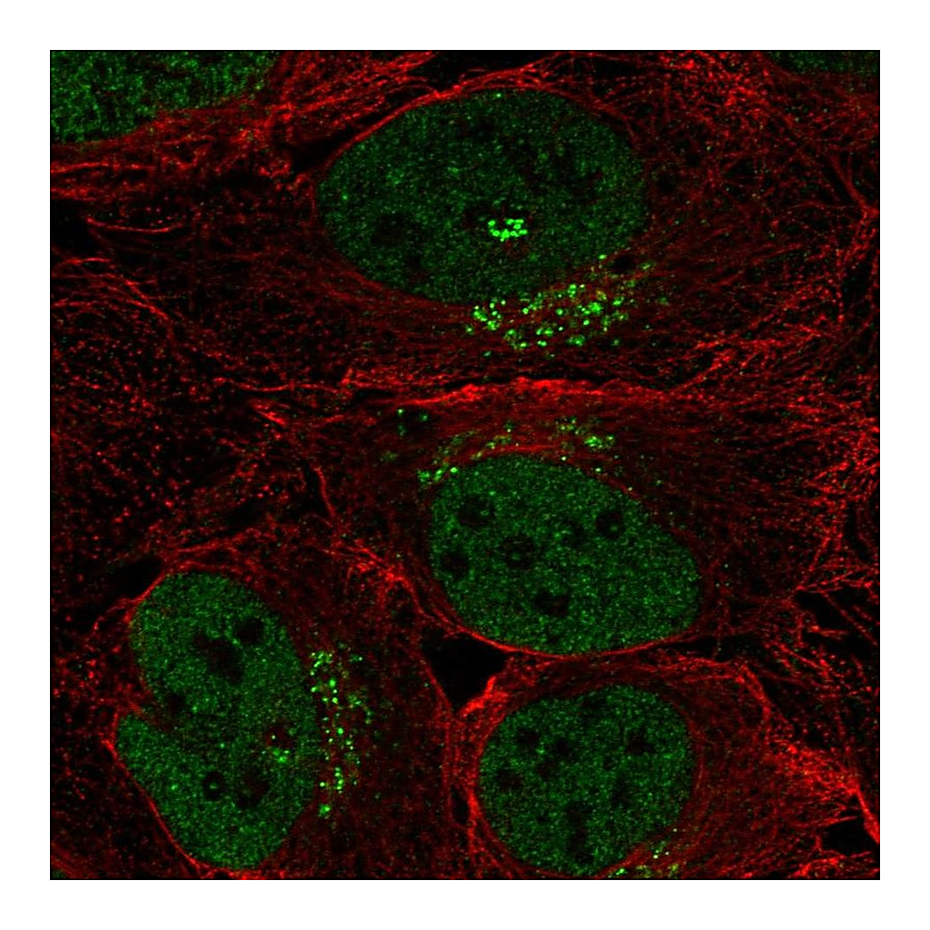 Atlas Antibodies Anti-SPSB4 Antibody