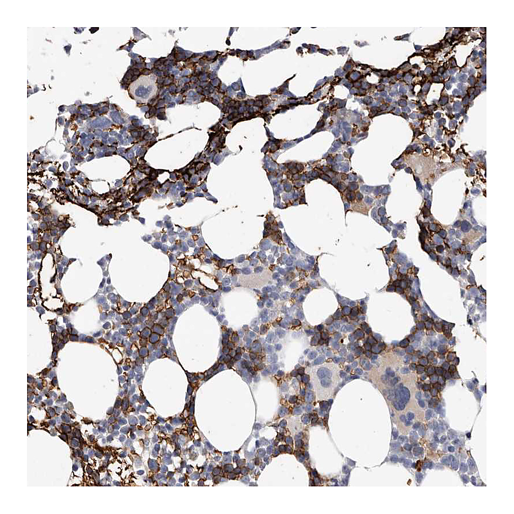 Atlas Antibodies Anti-SPTA1 Antibody
