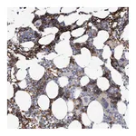 Atlas Antibodies Anti-SPTA1 Antibody