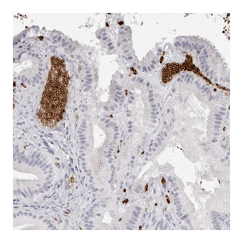 Atlas Antibodies Anti-SPTA1 Antibody