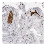 Atlas Antibodies Anti-SPTA1 Antibody