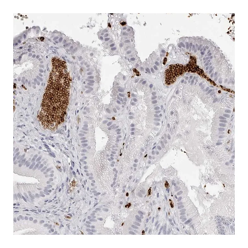 Atlas Antibodies Anti-SPTA1 Antibody