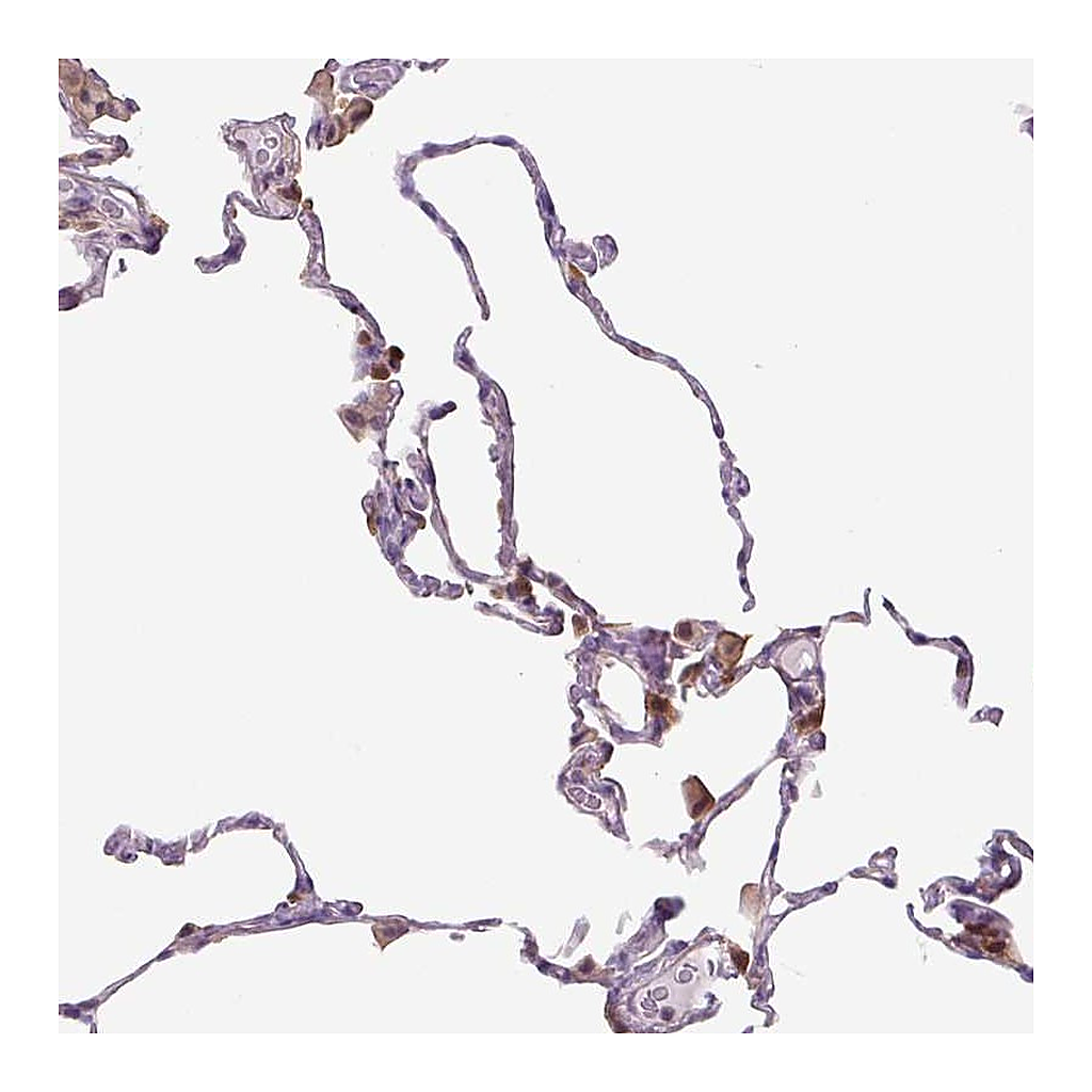 Atlas Antibodies Anti-SPSB2 Antibody