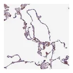 Atlas Antibodies Anti-SPSB2 Antibody
