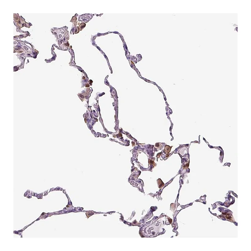Atlas Antibodies Anti-SPSB2 Antibody