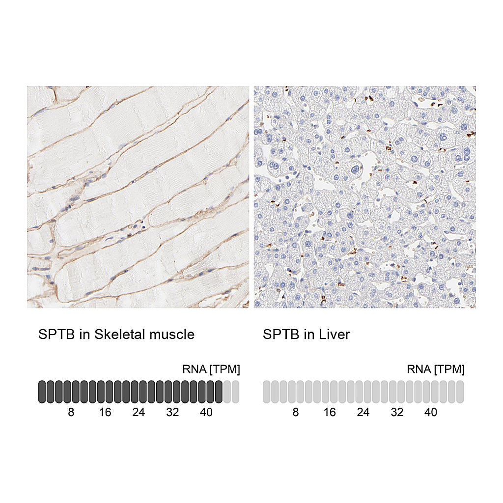 Atlas Antibodies Anti-SPTB Antibody